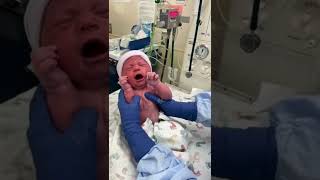 Newborn Baby First Cry After C-Section #shorts #shortsvideo #shortsfeed #short #shortvideo #shots