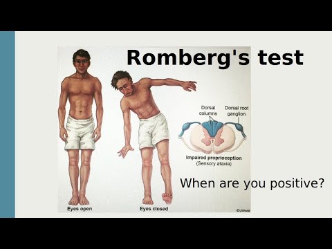 Video: Romberg test - what is it and what does Romberg's test show