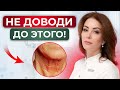 Почему кожа шеи СТАРЕЕТ? / Эффективные способы омоложения шеи и зоны декольте!