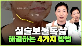 심술보 불독살 마리오넷주름 해결하고 싶으신 분? 시술 4가지 알려드릴게요.