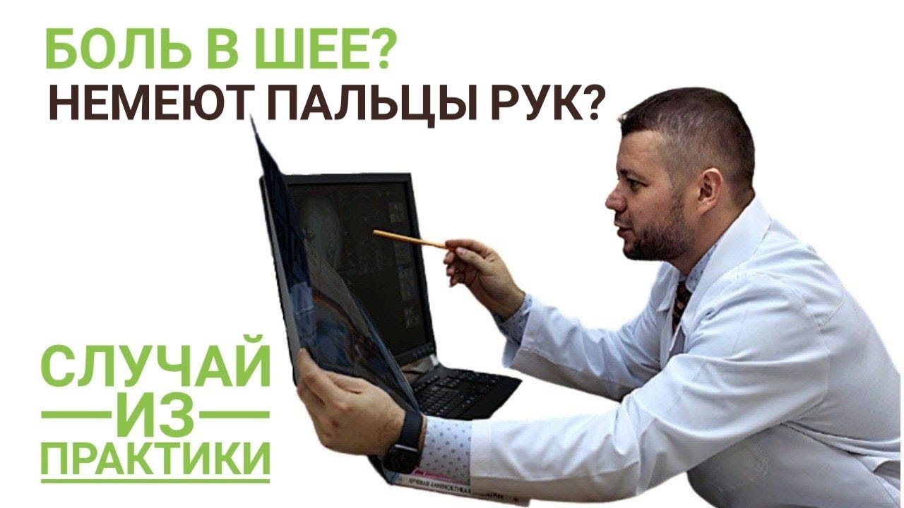 Боль в шее и онемение пальцев рук. (МРТ шейного отдела позвоночника)