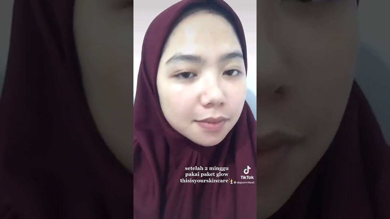 Hasil Dari 2 Minggu Pakai This Is Your Skincare