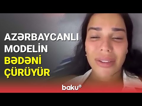 Plastik əməliyyat azərbaycanlı blogeri ölümə aparır