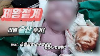 [KOR Parenting] The process of giving birth in Korea