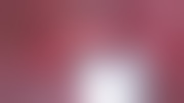 Left VATS Uniportal Apicoposterior (S1S2) Segmentectomy