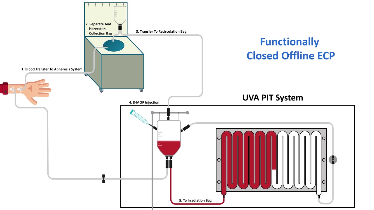 Leukapheresis, Collected By Automated Technology — Stanford Blood Center