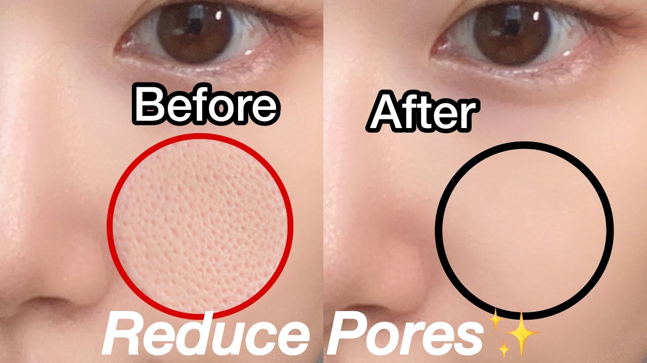 Korean Skin Care For Smaller Pores