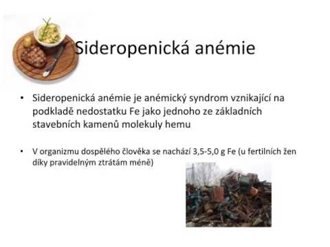 Video: Hemolytická Anémie: Příčiny, Příznaky A Diagnostika