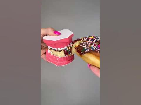 JUNKFOOD YOU CAN EAT WITH BRACES 🦷 BEST TREATS THAT WON'T BREAK YOUR
