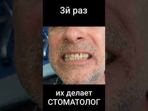Сустав височный пациента