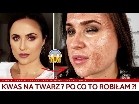 Wideo: Peeling Skóry Twarzy: Przyczyny I Leczenie