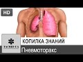 Пневмоторакс. Презентація Юрія Тарасюка