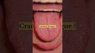 Your Tongue Tells Your Health! #HealthFacts #BodySigns #NaturalHealth #WellnessTips #HealthShorts