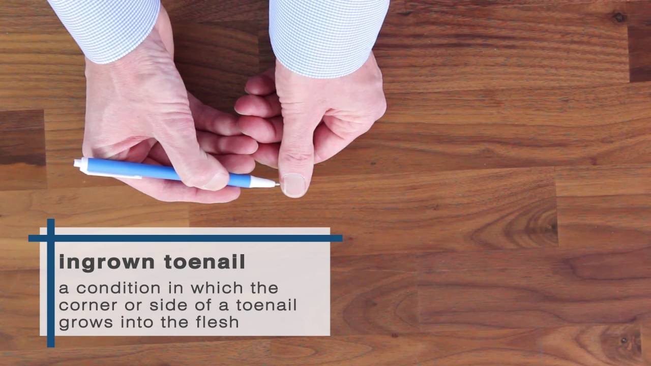 how to get rid of ingrown toenails how to get rid of ingrown toenails