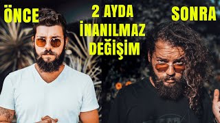 Hizli Saç Uzatma Yöntemleri̇ (Saç Dökülmesine Son)