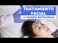 Tratamiento facial con botox  doctor leo cerrud