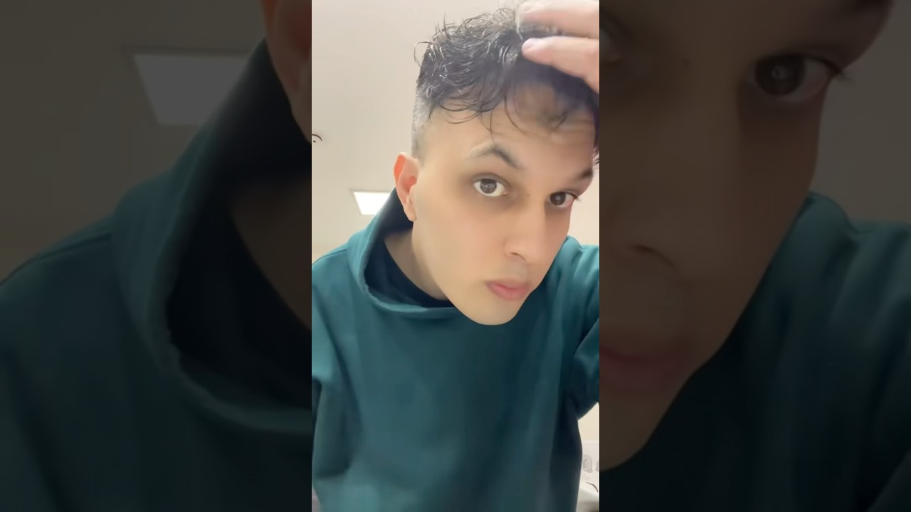 El antes y el después