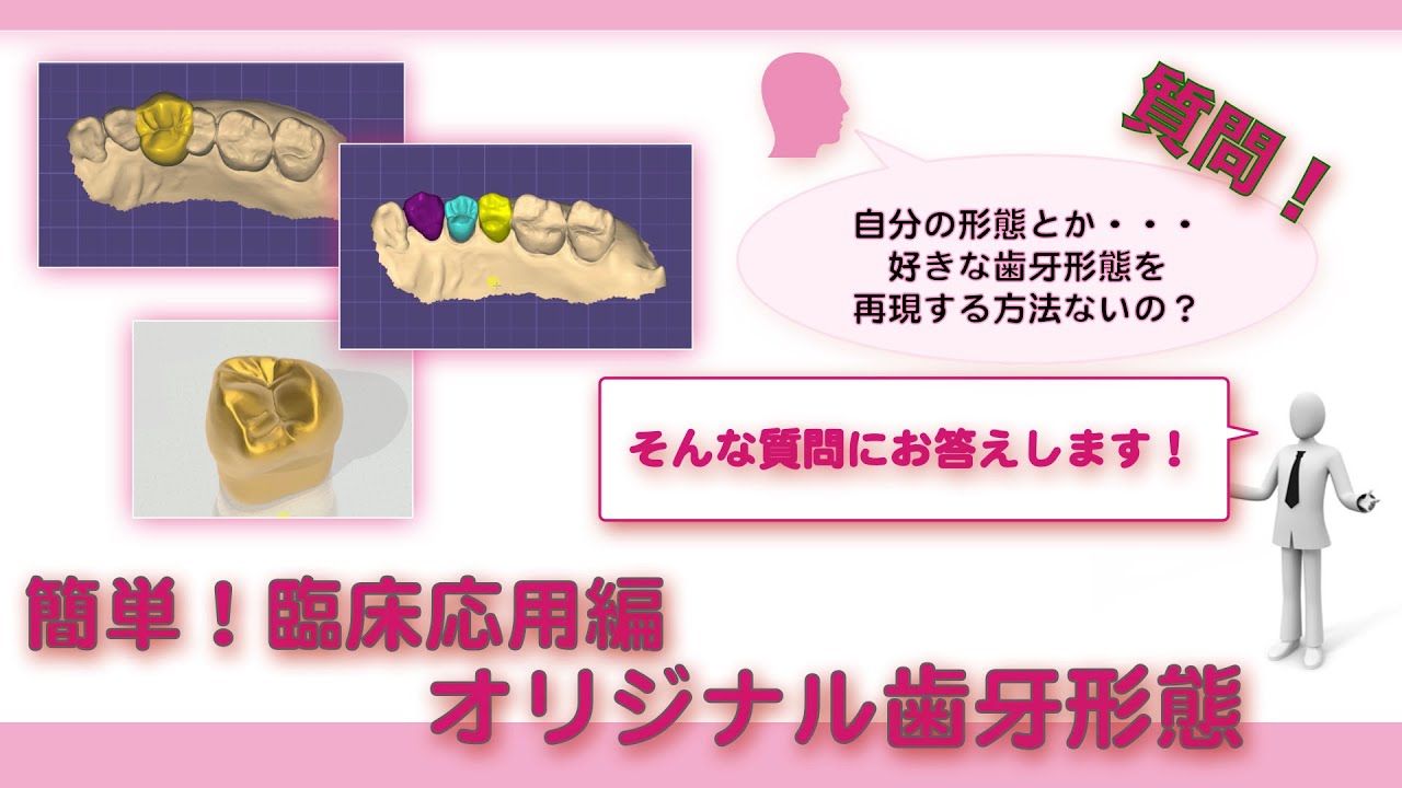 exocad】簡単！臨床応用編 オリジナル歯牙形態 - YouTube