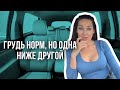 Неидеальность | Грудь норм, но одна ниже другой