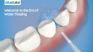 See How ORACURA Water Flosser is better than manual flossing