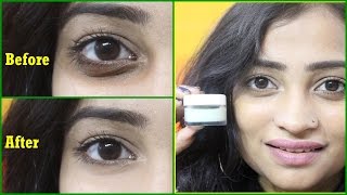 Homemade UNDER EYE CREAM to Remove DARK CIRCLES, Wrinkles | 100% Effective Natural UNDER EYE GEL