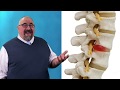 Can Degenerative Disc Disease Qualify for SSDI? | Citizens Disability