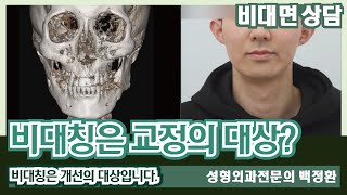 (SUB) 비대칭은 교정의 대상이 아닙니다 [비대면상담 267] / Asymmetry is not subject to correction.