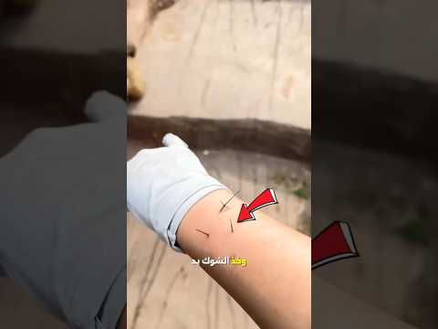 طلبت المساعدة من القرد