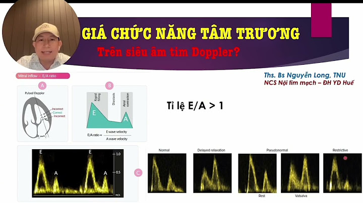 Rối loạn chức năng tâm trương là gì năm 2024