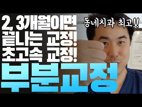 동네치과 궈궈 2 3달에 끝나는 빠른 치아교정이 있다 부분교정 