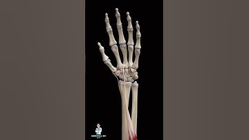 How A Tendon Can Replace Trapezium Bone In Thumb Arthritis? (3D Animation)  #3dmedicalanimation