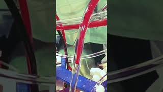 🫀.... Perfusionist.#lifeisbutadream #medical #song