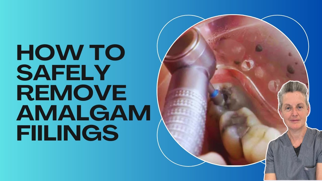  How Are Mercury Fillings Removed Safely Holistic Dentists Brisbane