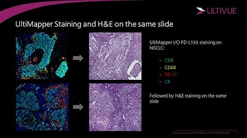 Phenotyping the tumor micro-environment with advanced tissue-based multiplexing assays
