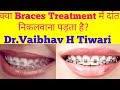 Kya braces treatment me dant nikalwana padta hai | extraction of tooth for  making space |