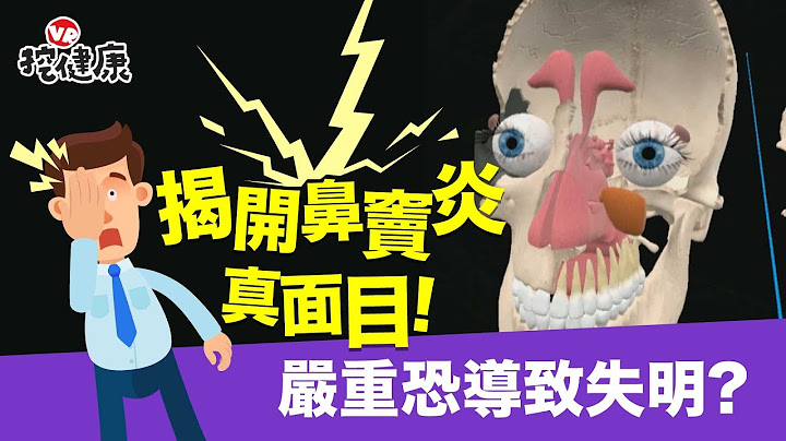 揭开 鼻窦炎 真面目！严重恐导致 失明 嗅觉失常 脑膜炎 ！自我诊断这样看【VR挖健康】EP5 - 天天要闻