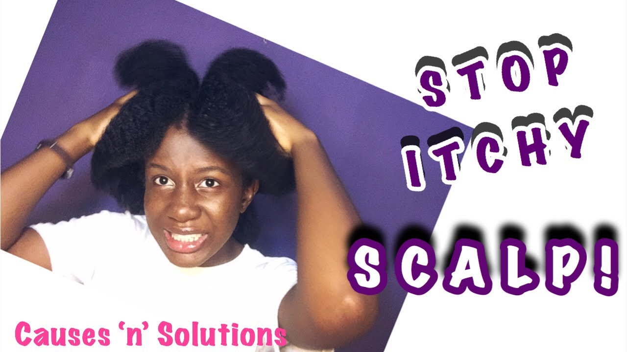 HOW TO STOP ITCHY SCALP(DETAILED VIDEO),DIFFERENT CAUSES & SOLUTIONS
