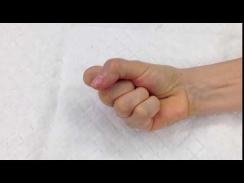 Trigger Finger