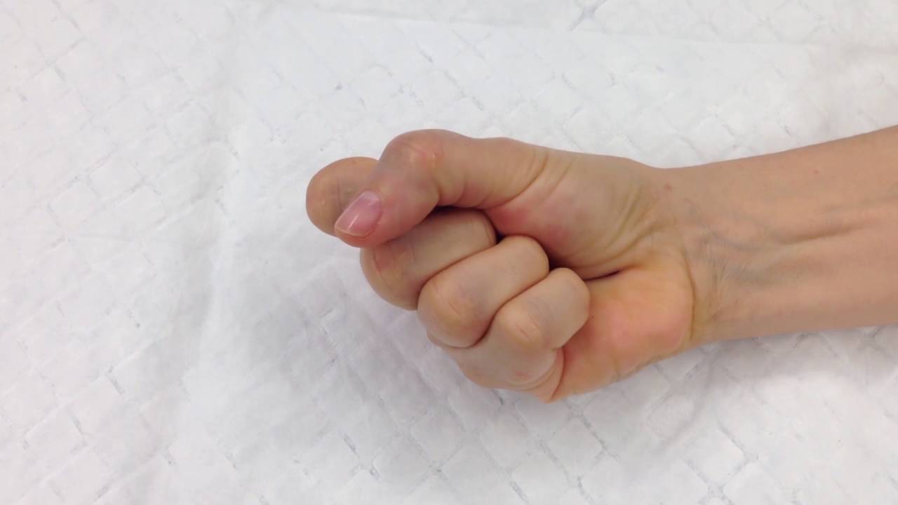 Trigger Finger Youtube Trigger Finger Youtube