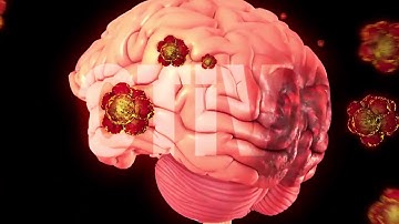 Ngừa nguy cơ đột quỵ khi thời tiết lạnh bất thường