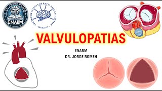 VALVULPATIAS - ENARM - TODO LO QUE NECESITAS SABER