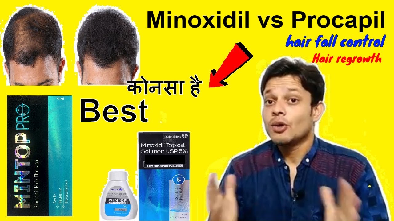 Mintop Gain 5 Topical Solution 60ml  Baby Care  Health Care  Personal  Care Products at Lowest Price in India