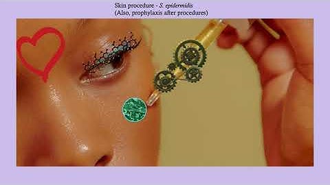 Short story: Staphylococcus epidermis