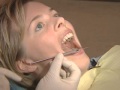 Mandibular Anesthesia - Gow-Gates Block