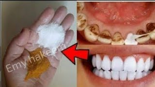 تبييض الاسنان واسقاط الجير في 1 دقيقة،حول اسنانك من صفراء الى بيضاء لامعة كاللؤلؤ