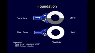 Myocardial Perfusion Imaging