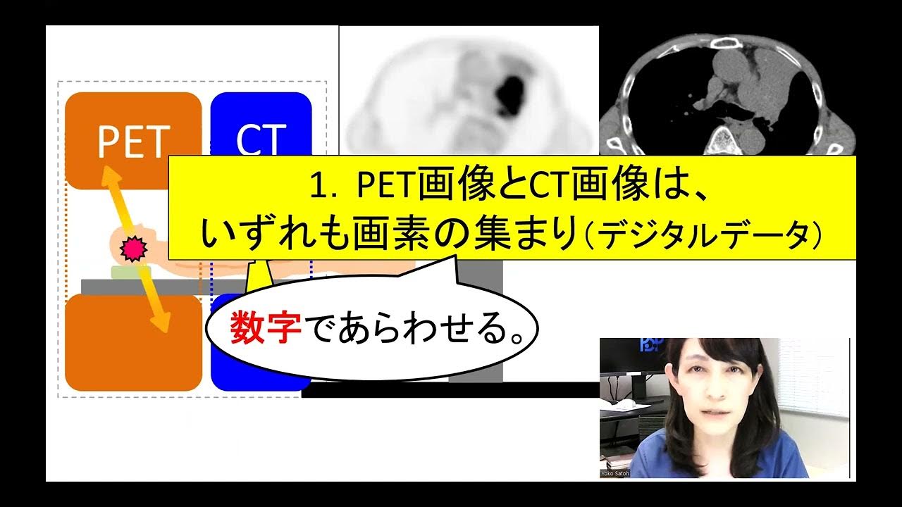 PET/CTのCTが実はすごいという話・その2。