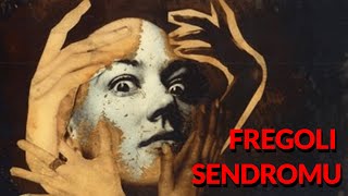 En Kötü Psi̇koloji̇k Rahatsizlik Fregoli̇ Sendromu