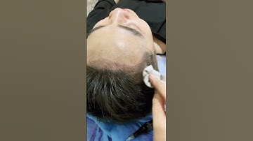 Điêu khắc chân tóc mái cho nam siêu nét - Tít Mi