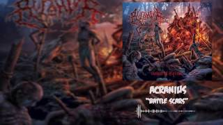 The Heaviest Slamming Brutal Death Metal Grooves / Breakdowns for 2017